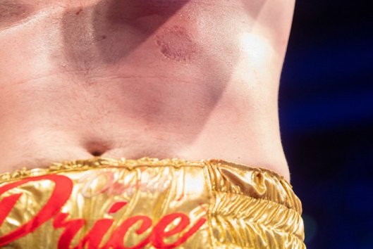 david-price-ali-fight (7)